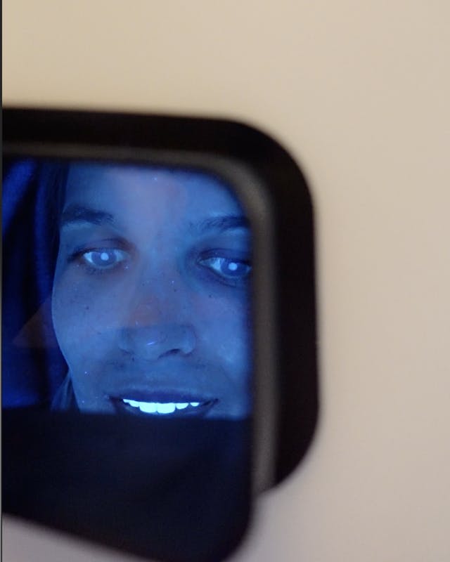 Le DiagnoSkin : analyse de votre peau à la lumière UV par une experte Maison Yoko centre de médecine esthétique à Lyon