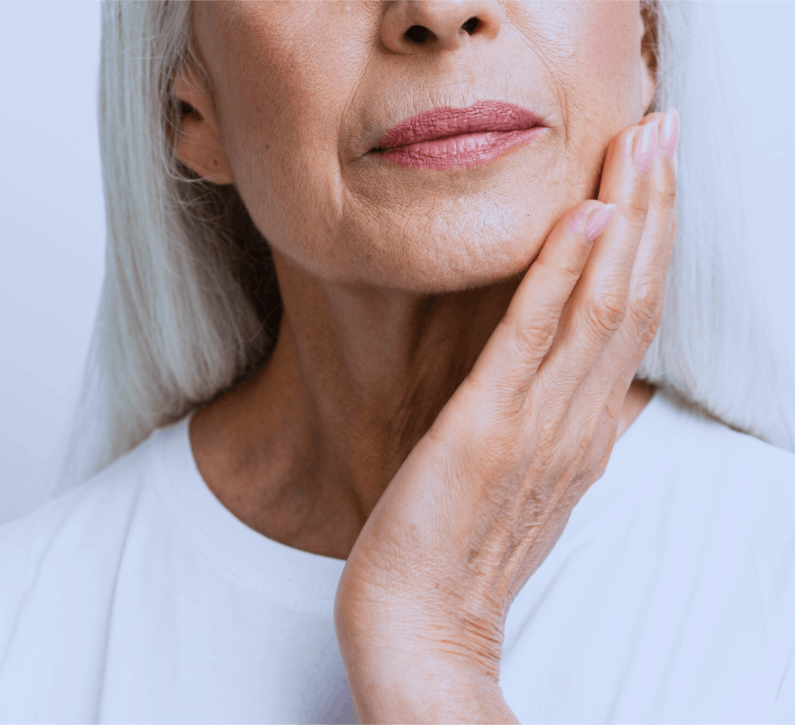 Femme agée avec relachement cutané