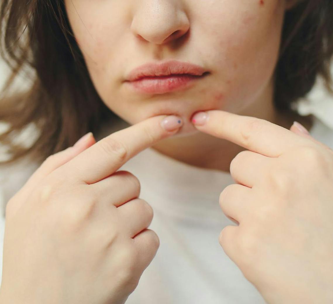 enlever les points noirs à la main