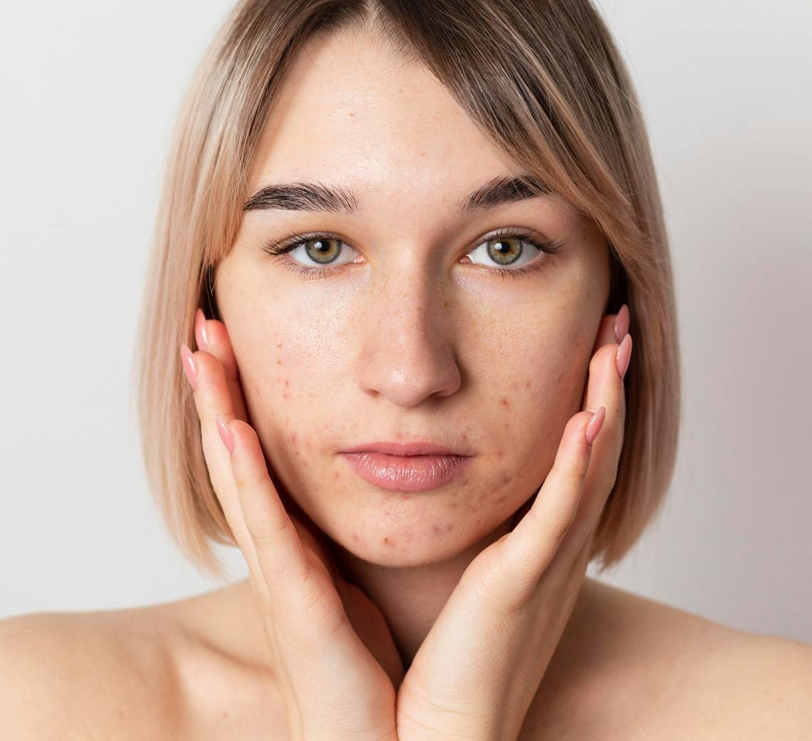 risques effets secondaires botox anti transpiration
