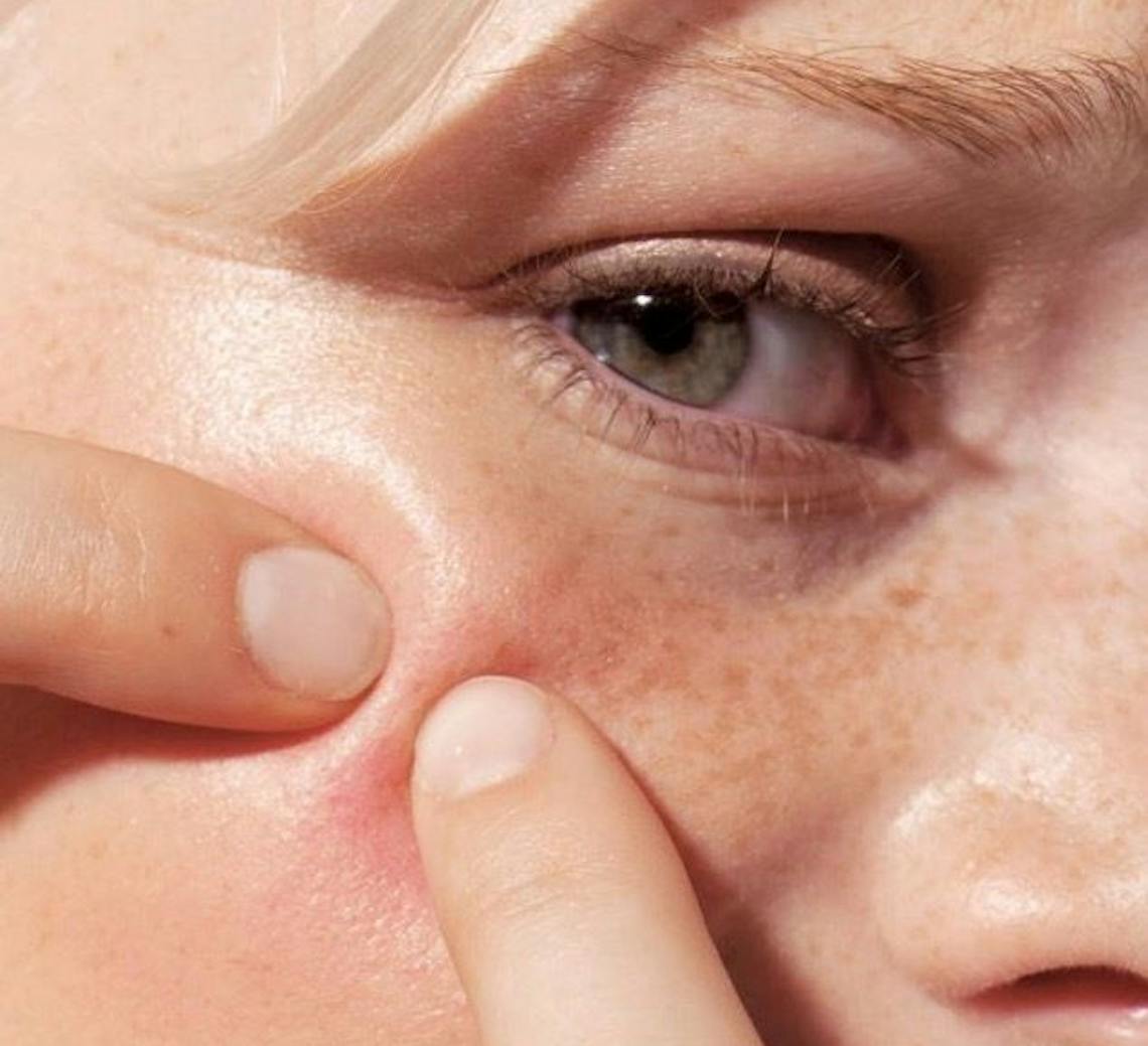 Triturer ses boutons : la fausse bonne idée.