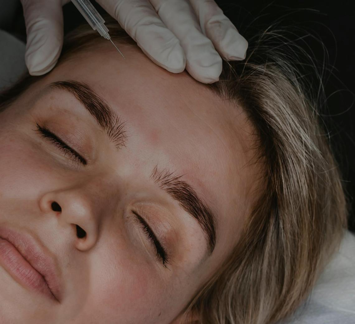 cicatrice détatouage laser