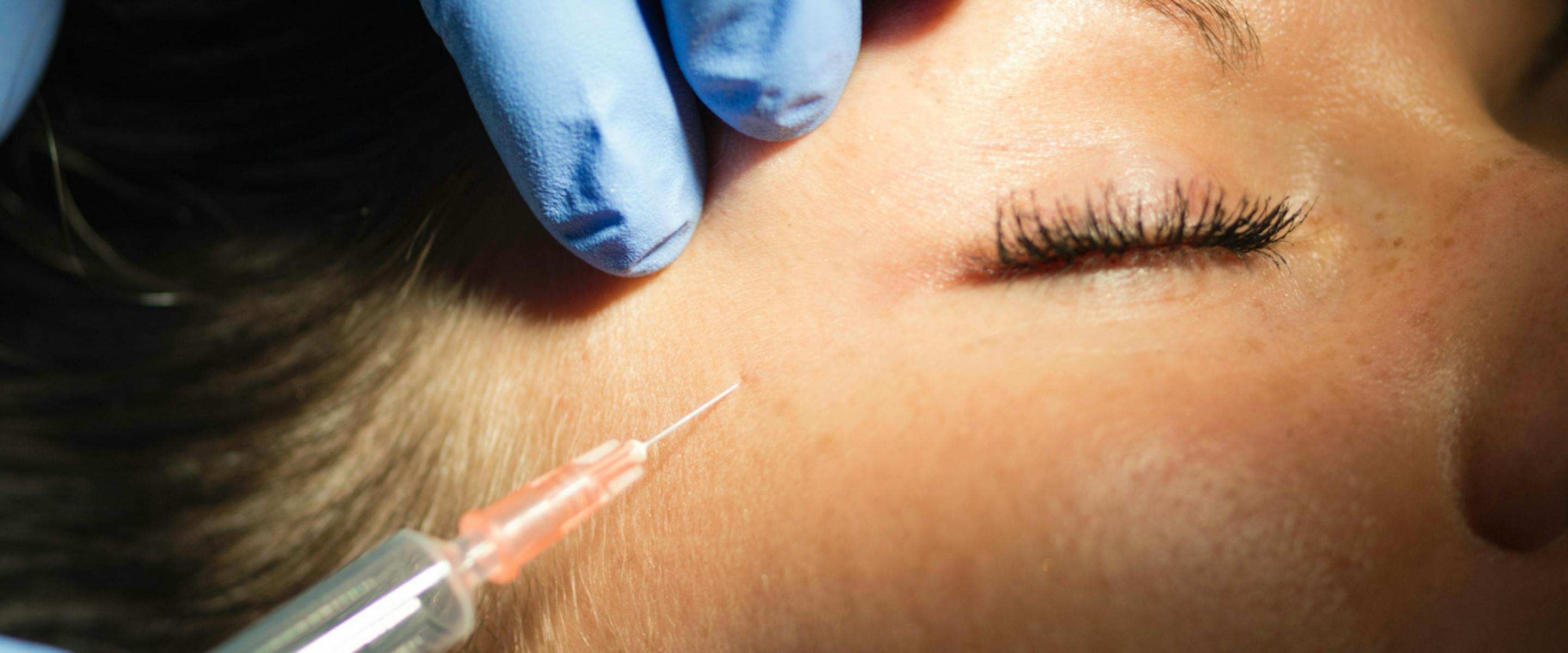 injection esthétique en été