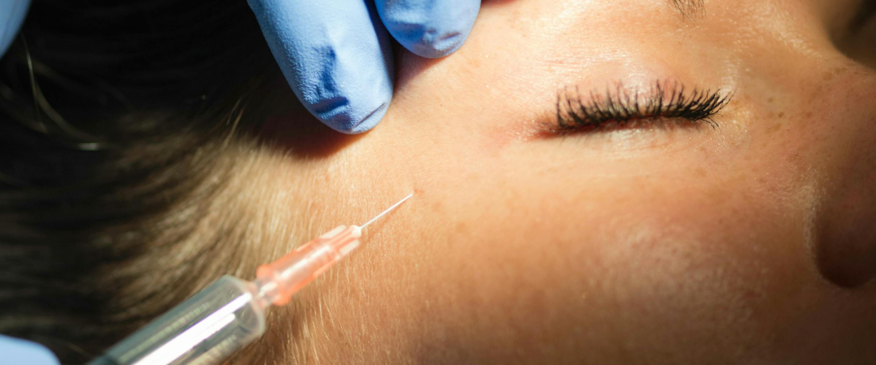 Injections de Botox dans le visage d'une jeune femme