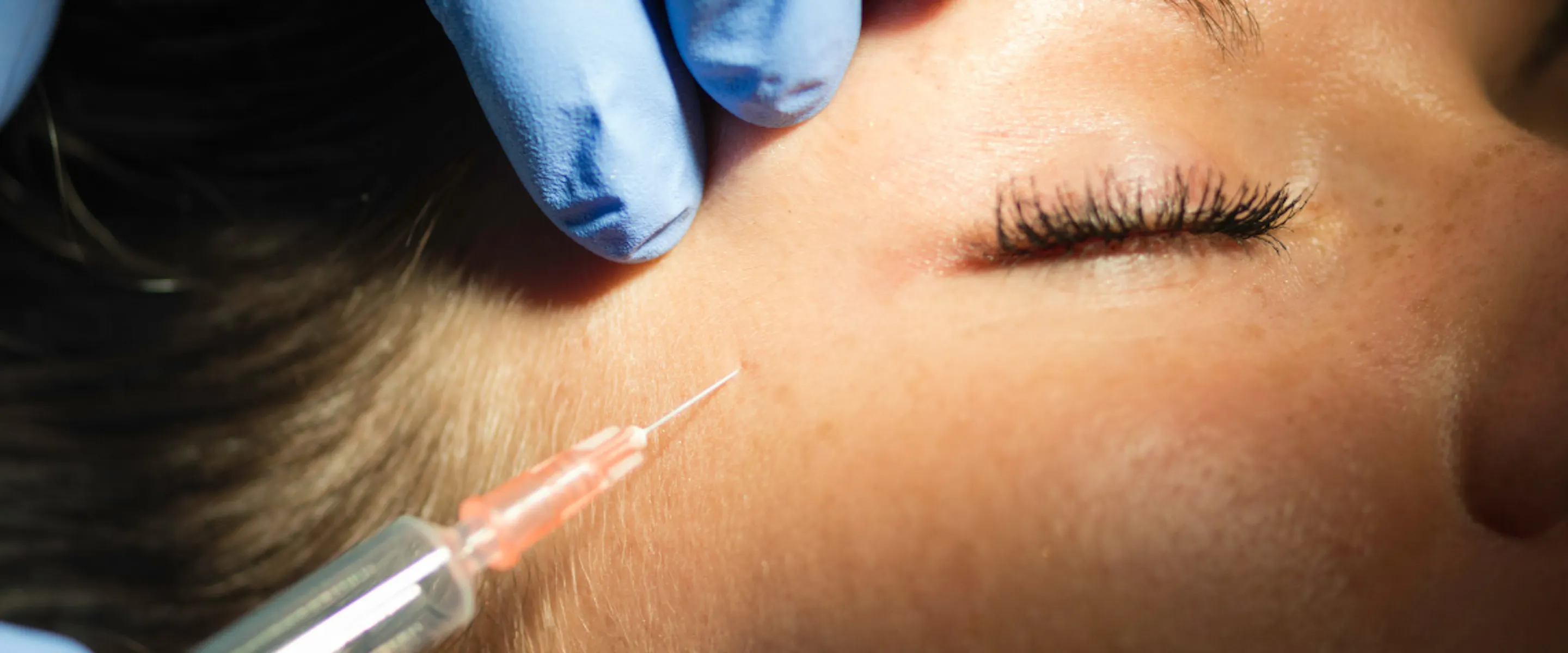 botox préventif chez Maison Yokō : prévenir l'apparition des rides sur le visage