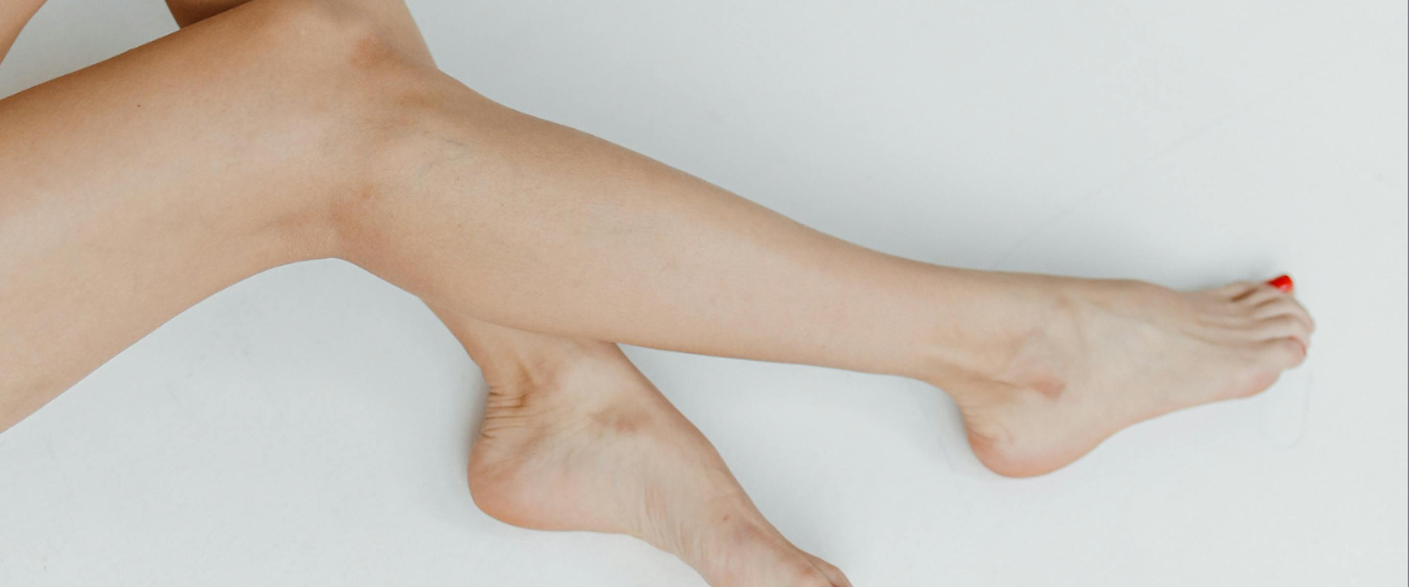 Jambes jeune femme épilation laser