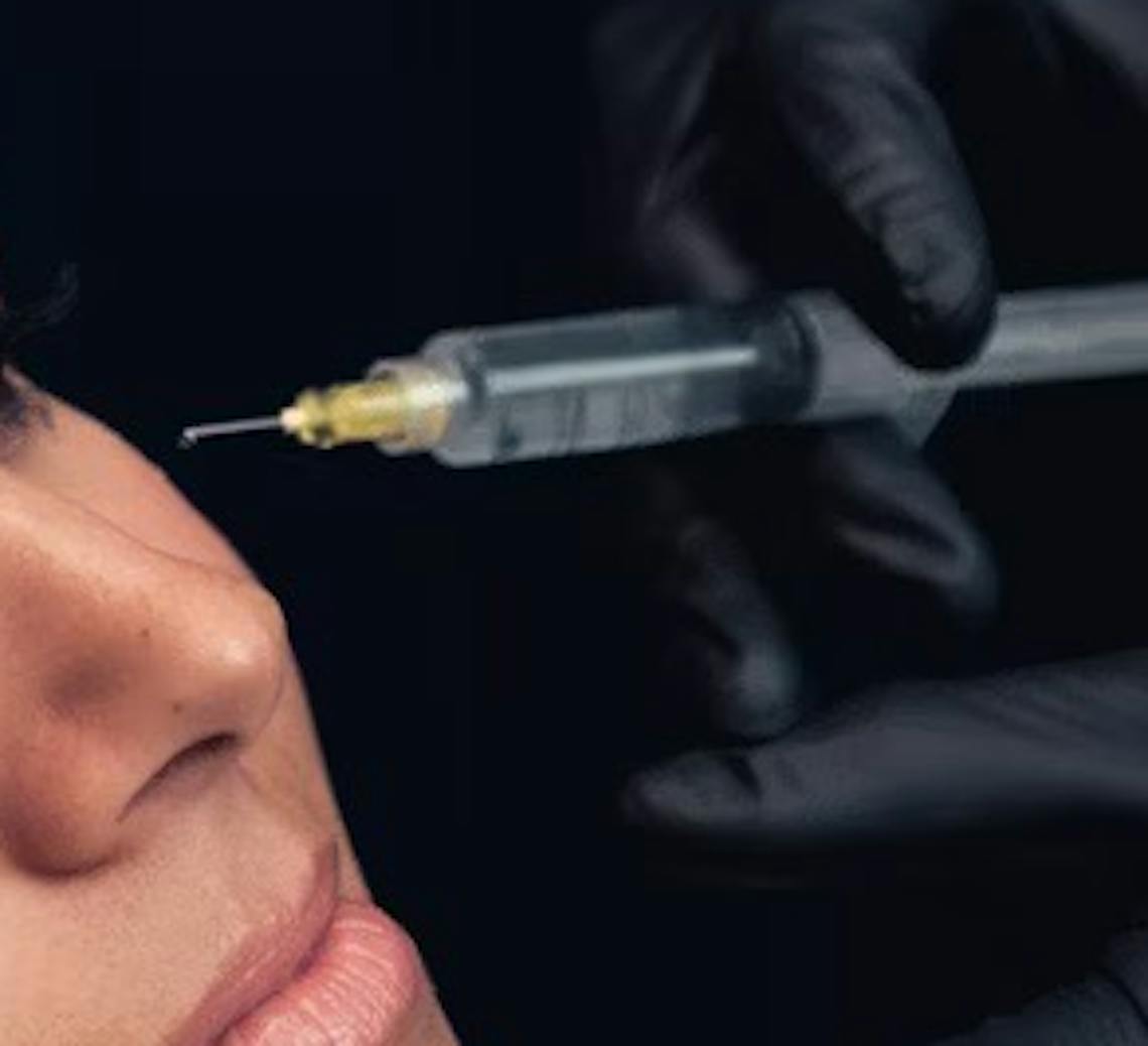 mésothérapie à lyon