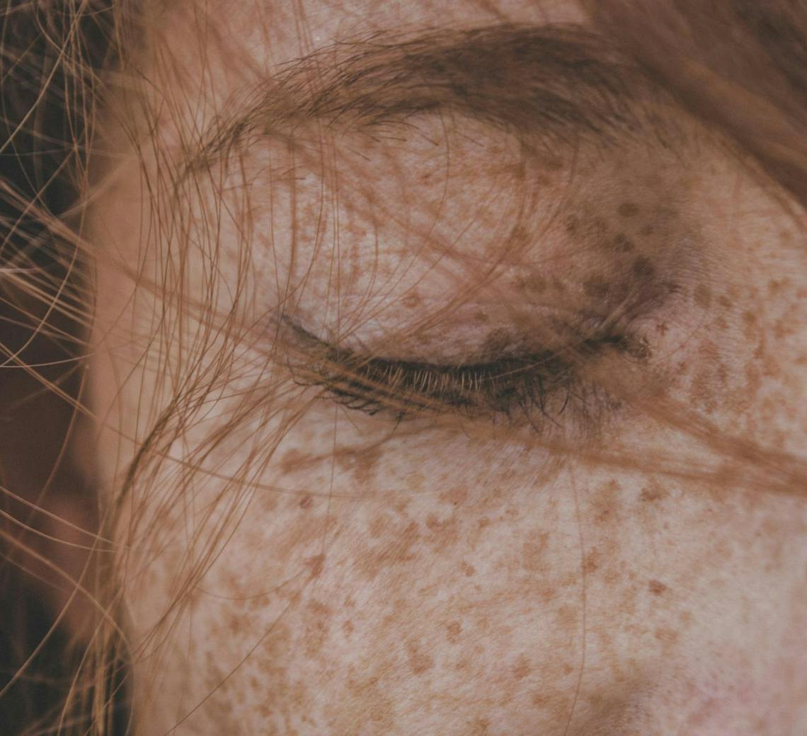 traitement des taches brunes sur le visage