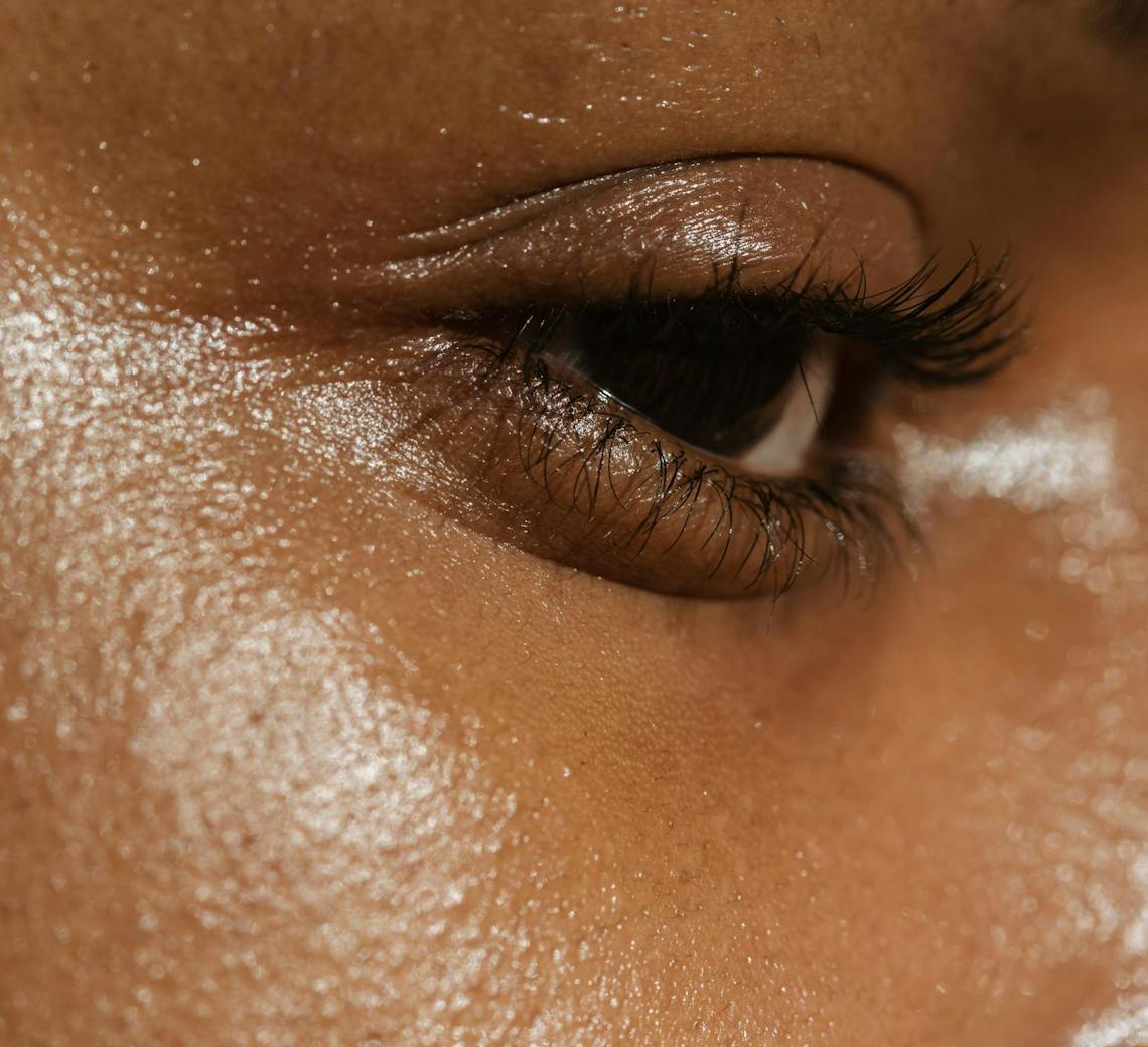 risque hyperpigmentation