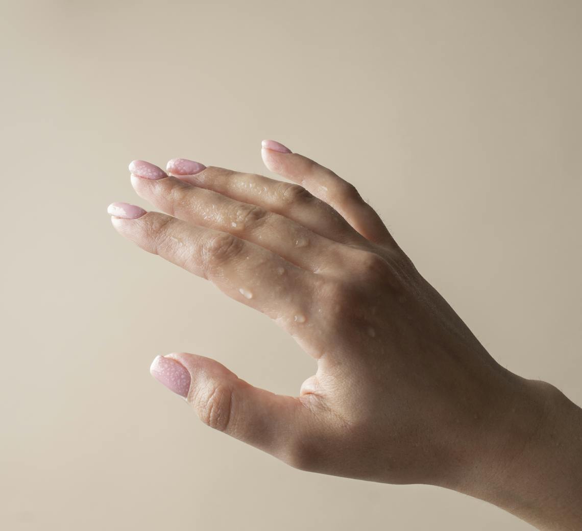 transpiration des mains solution soin botox