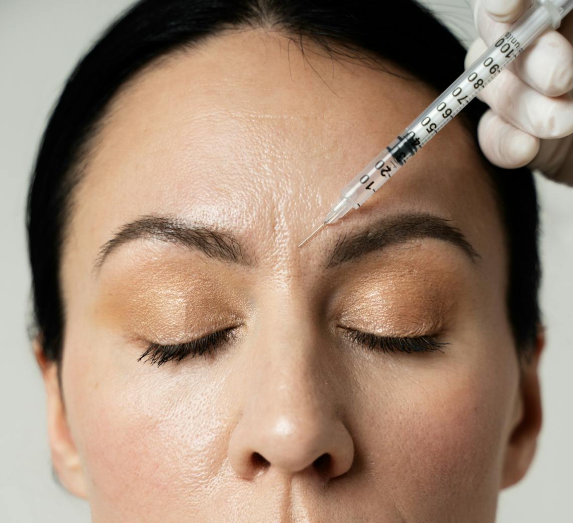 effet du botox contre la transpiration