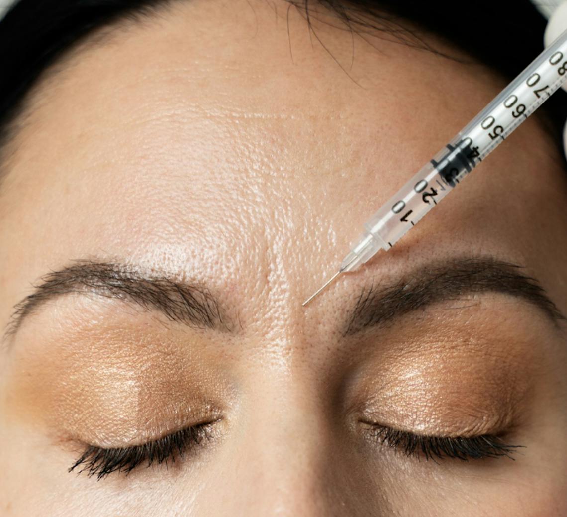 skinbooster | acide hyaluronique pour le visage