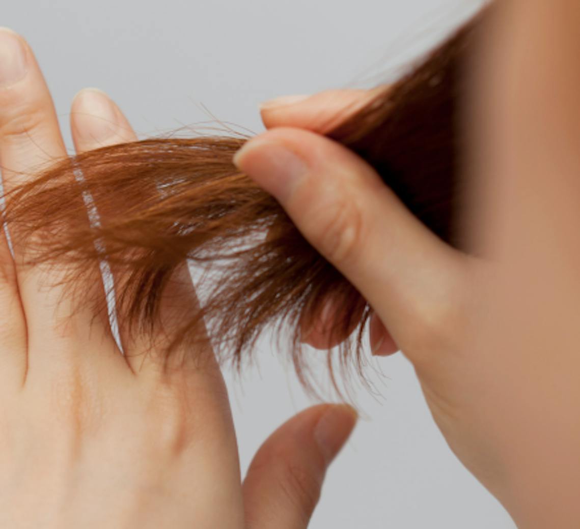 mésothérapie cheveux de femme