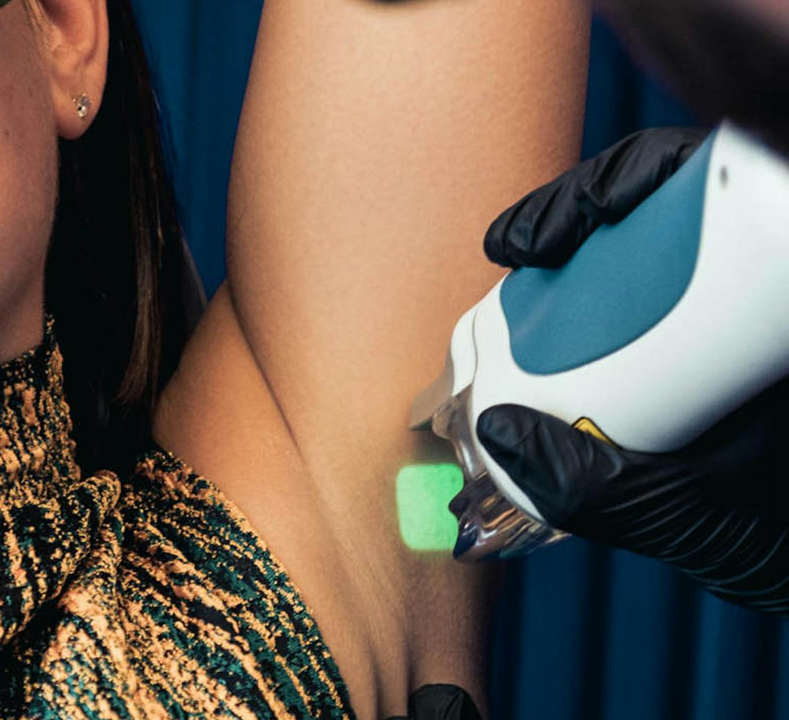 epilation laser aisselle maison yoko