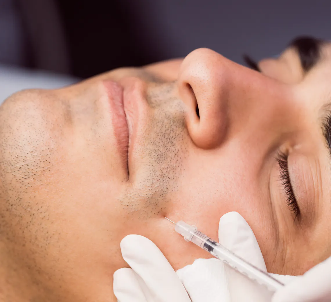 injection d'acide hyaluronique et de Botox pour homme à Lyon