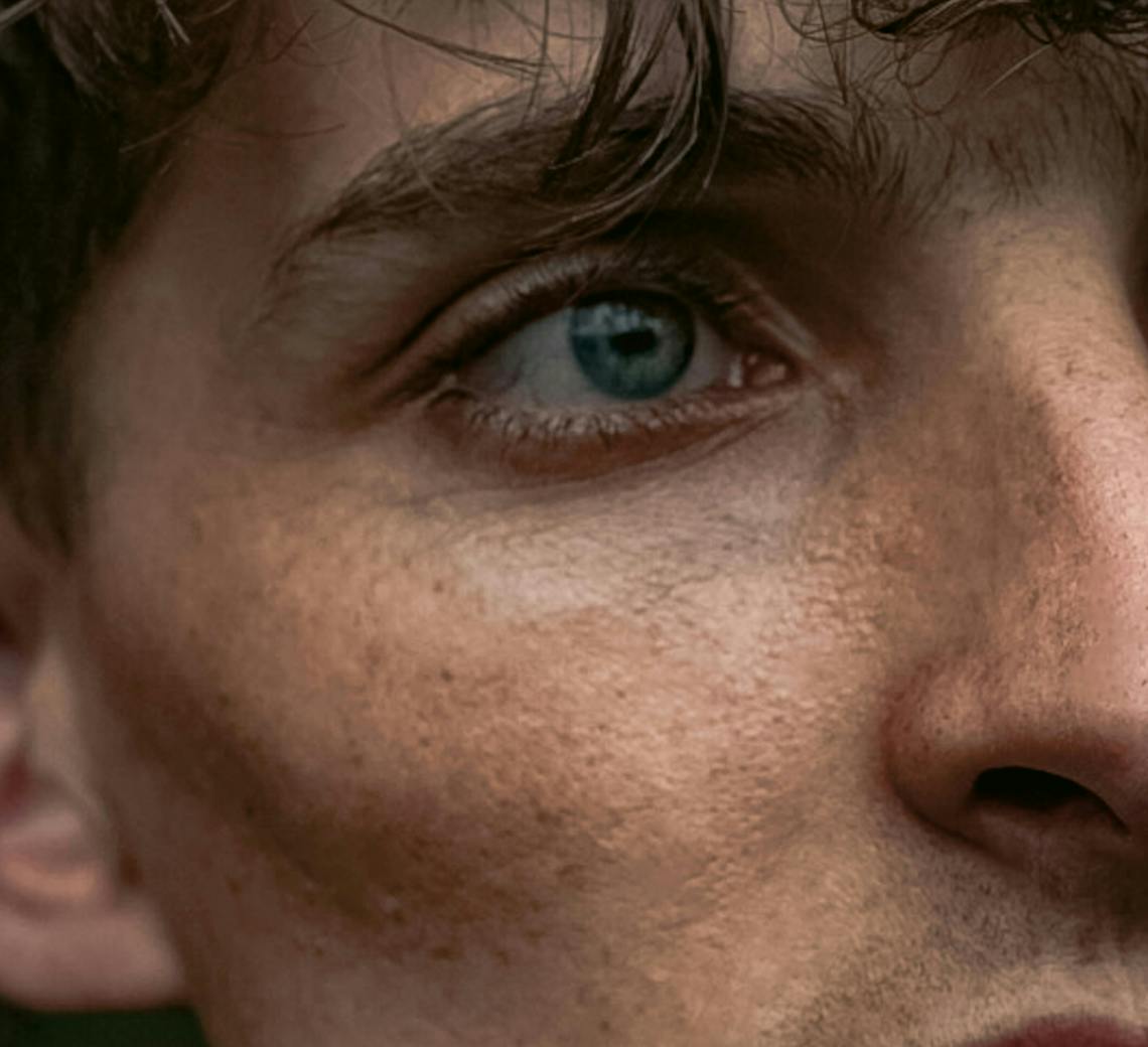 injecter botox ou acide hyaluronique pour homme