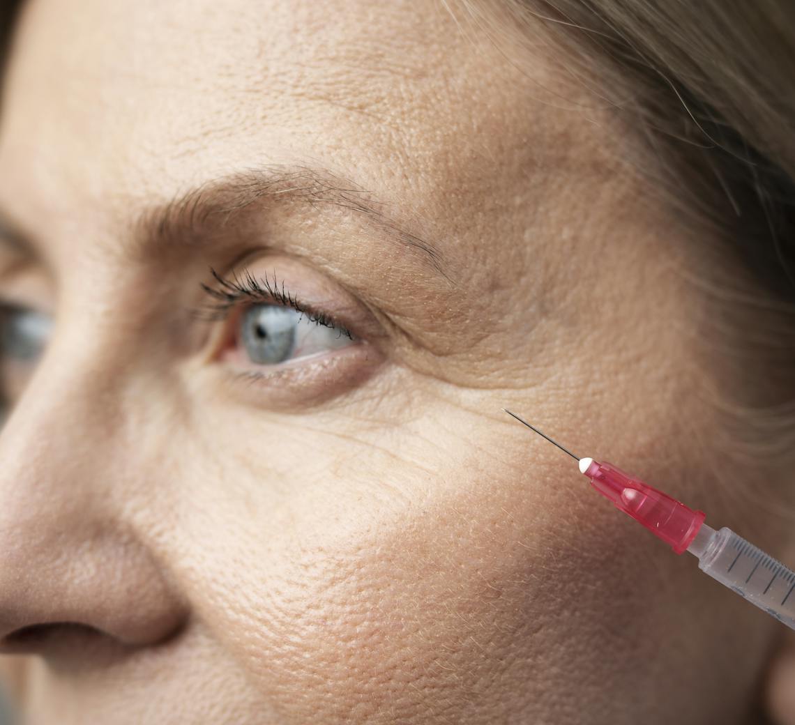 skinbooster pour le visage