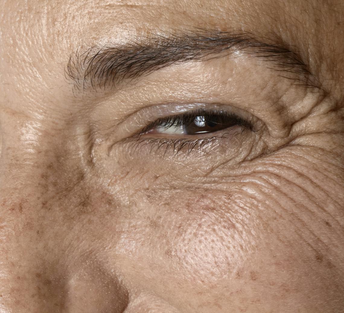 atténuer les rides du visage
