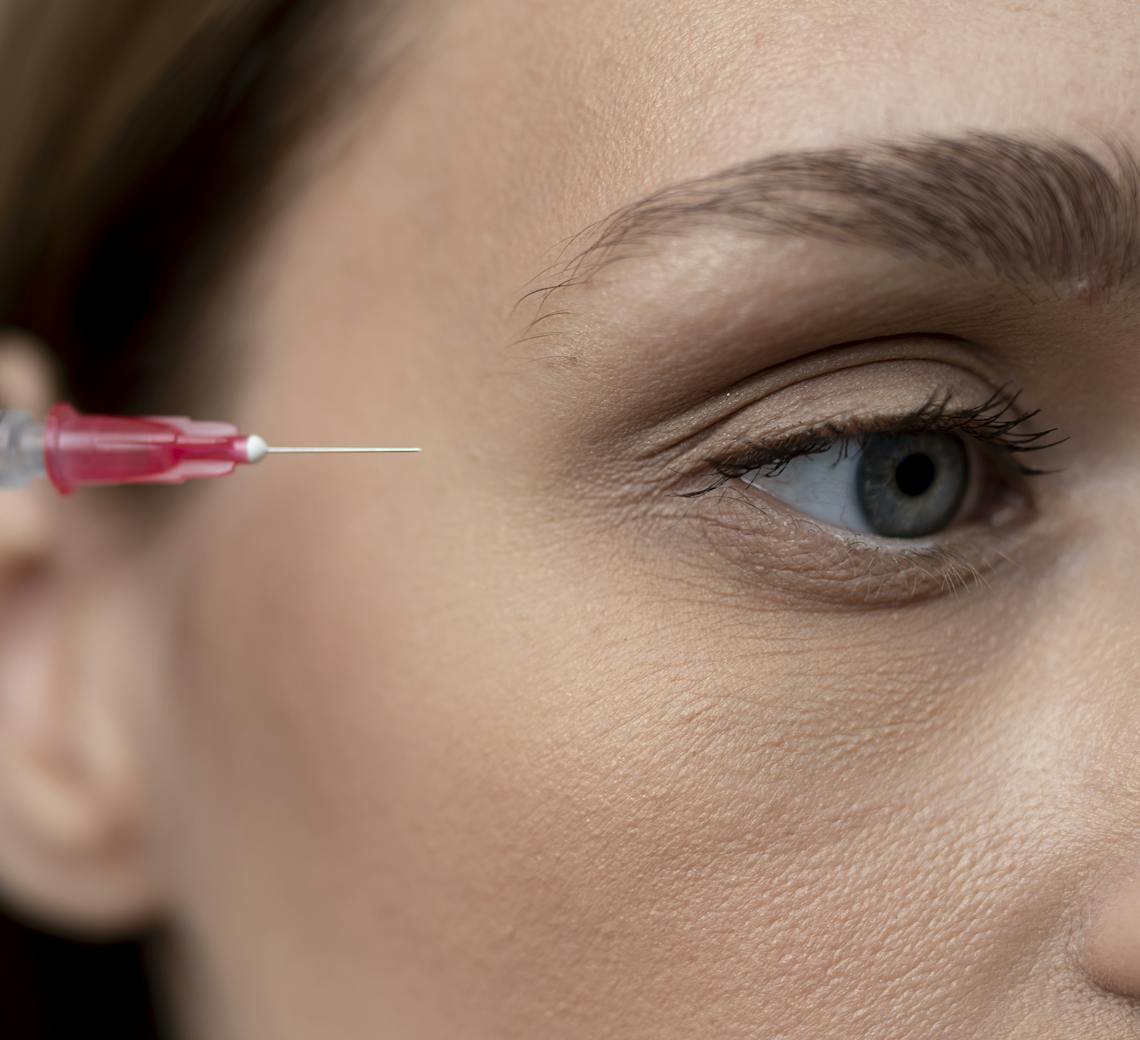 injection pour traiter les rides sous les yeux
