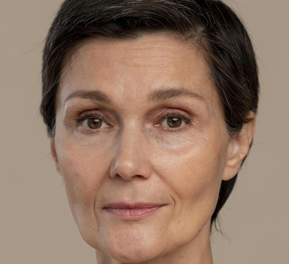 résultat naturel après injections