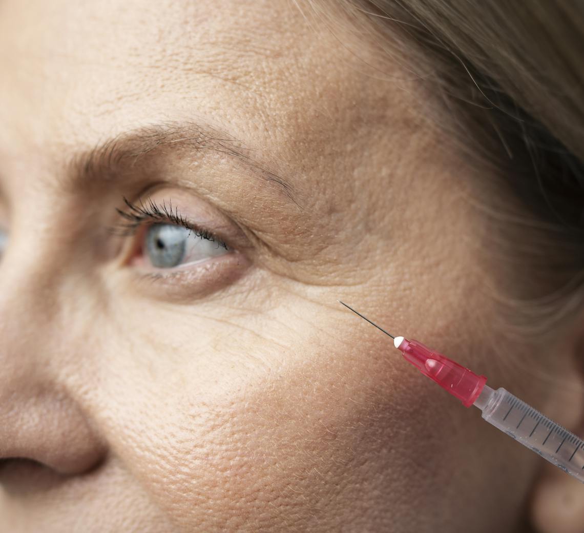 injection d'acide hyaluronique