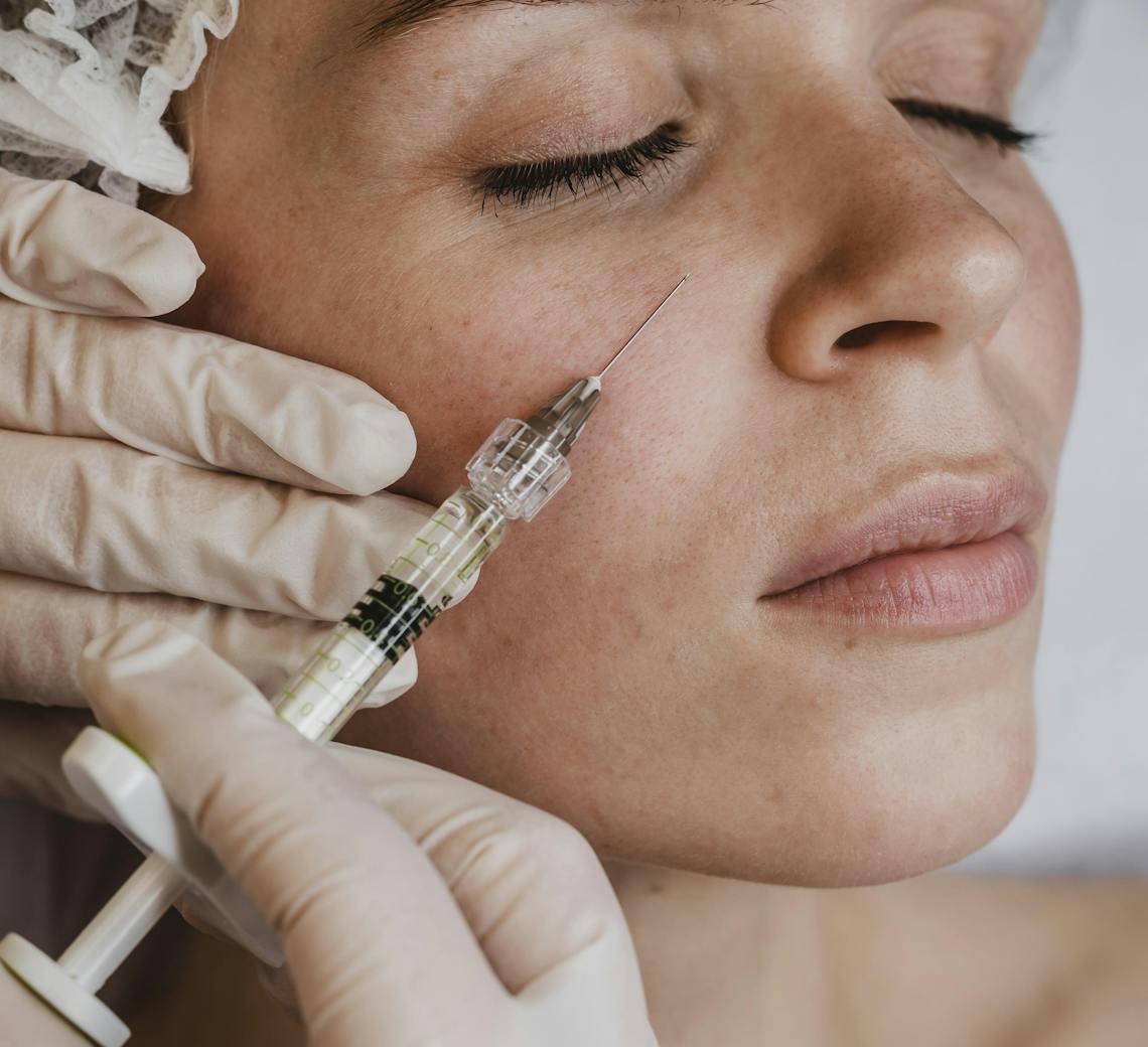 effets du botox sur les rides