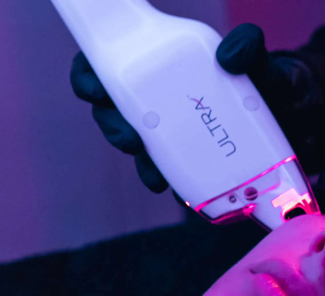 le laser en été : pourquoi c'est une mauvaise idée ?