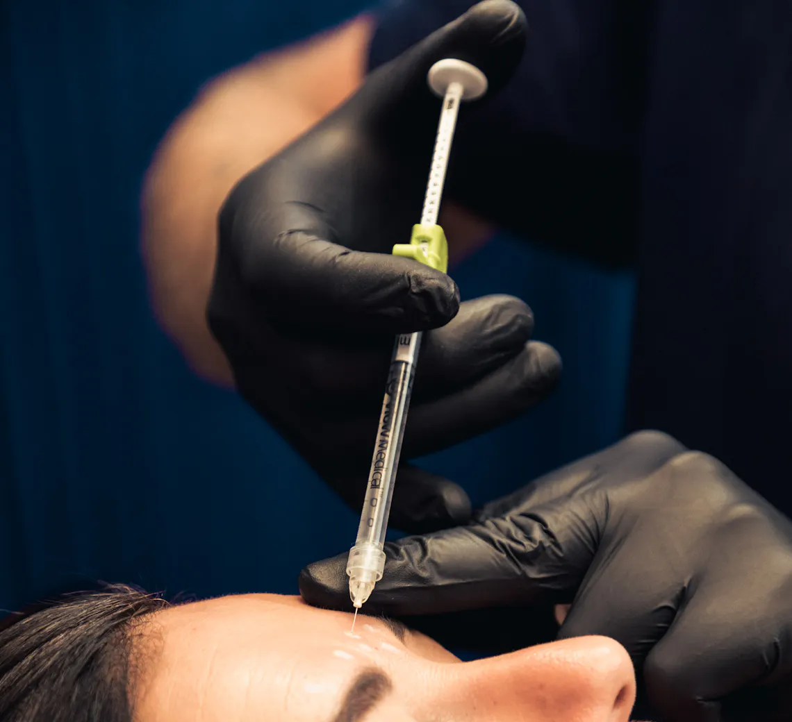 injection de botox et d'acide hyaluronique à lyon chez Maison Yokō