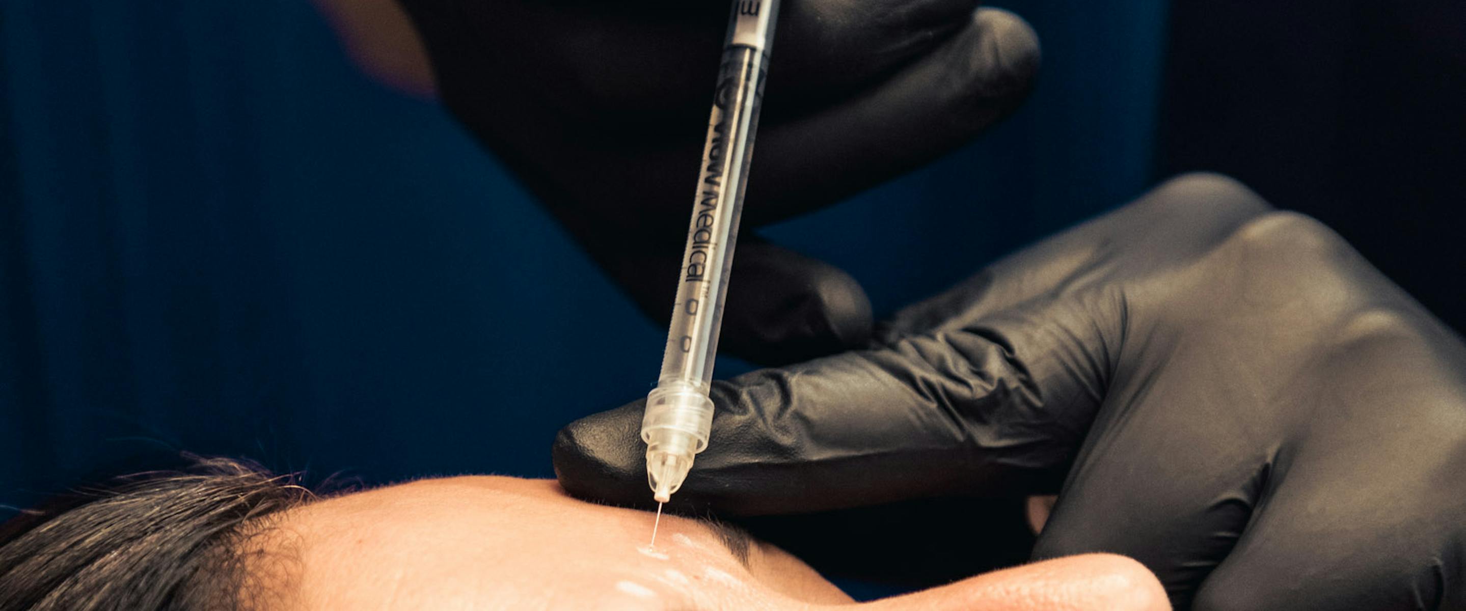 injection de botox et sport | Maison Yokō