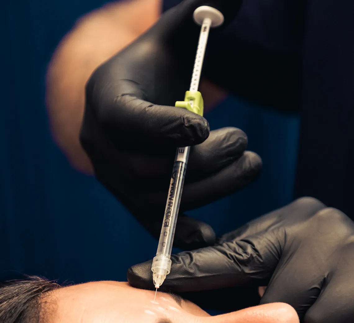 résultats d'une injection sur le visage