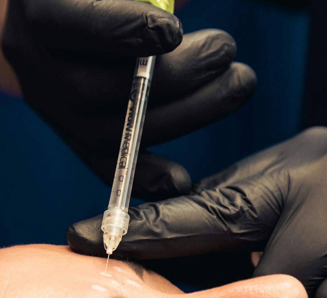 injections esthétiques et soleil