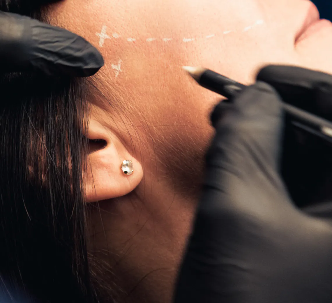 inducteurs de collagène sur le visage | Maison Yokō