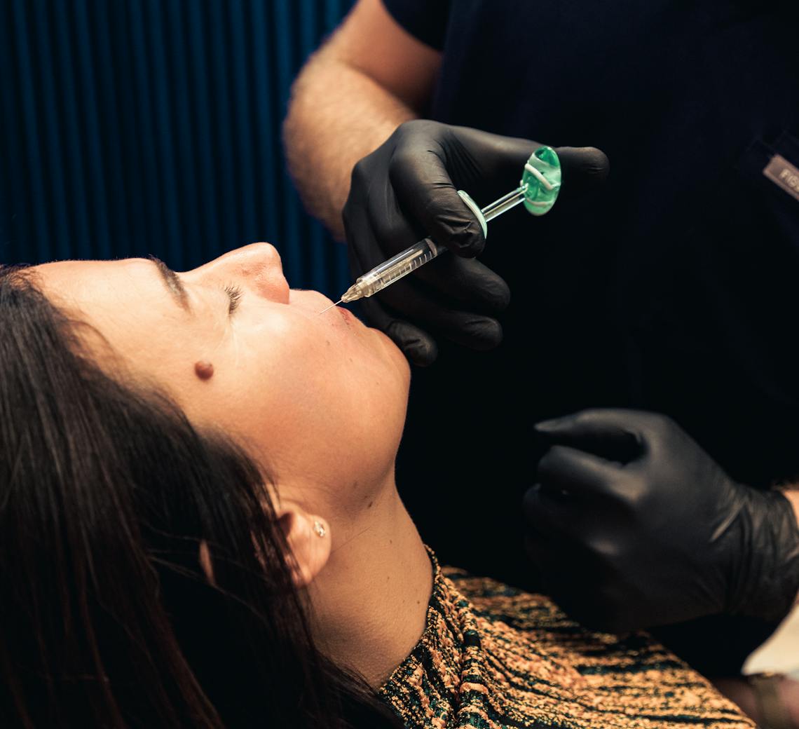 comment combler les rides du visage