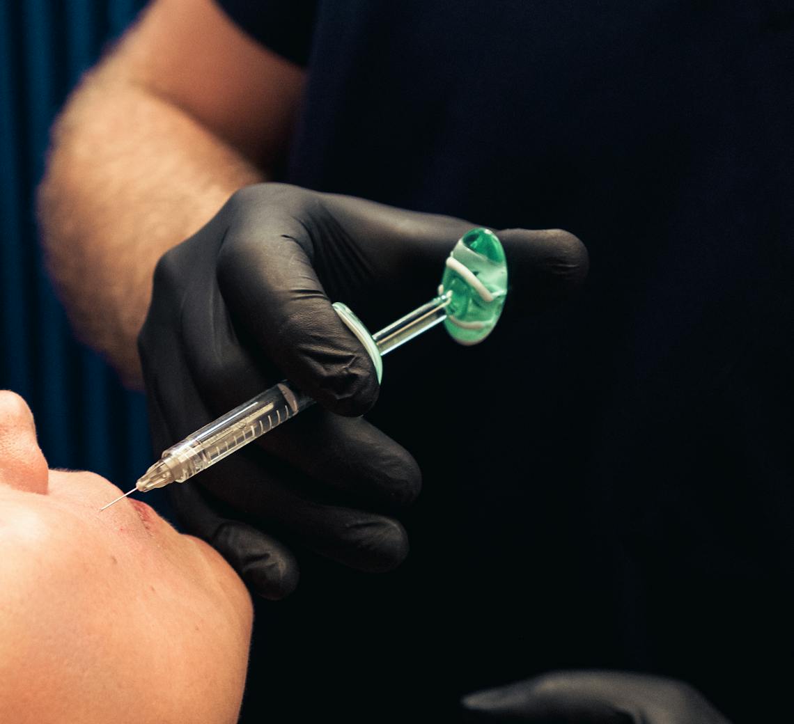 injection d'acide hyaluronique naturelle à lyon chez Maison Yokō