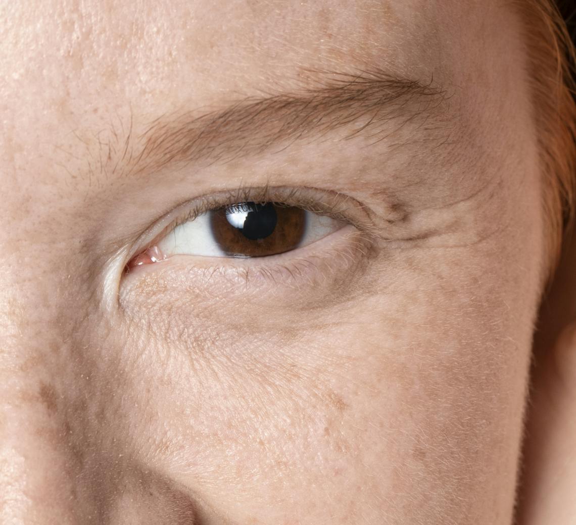 améliorer la qualité de peau