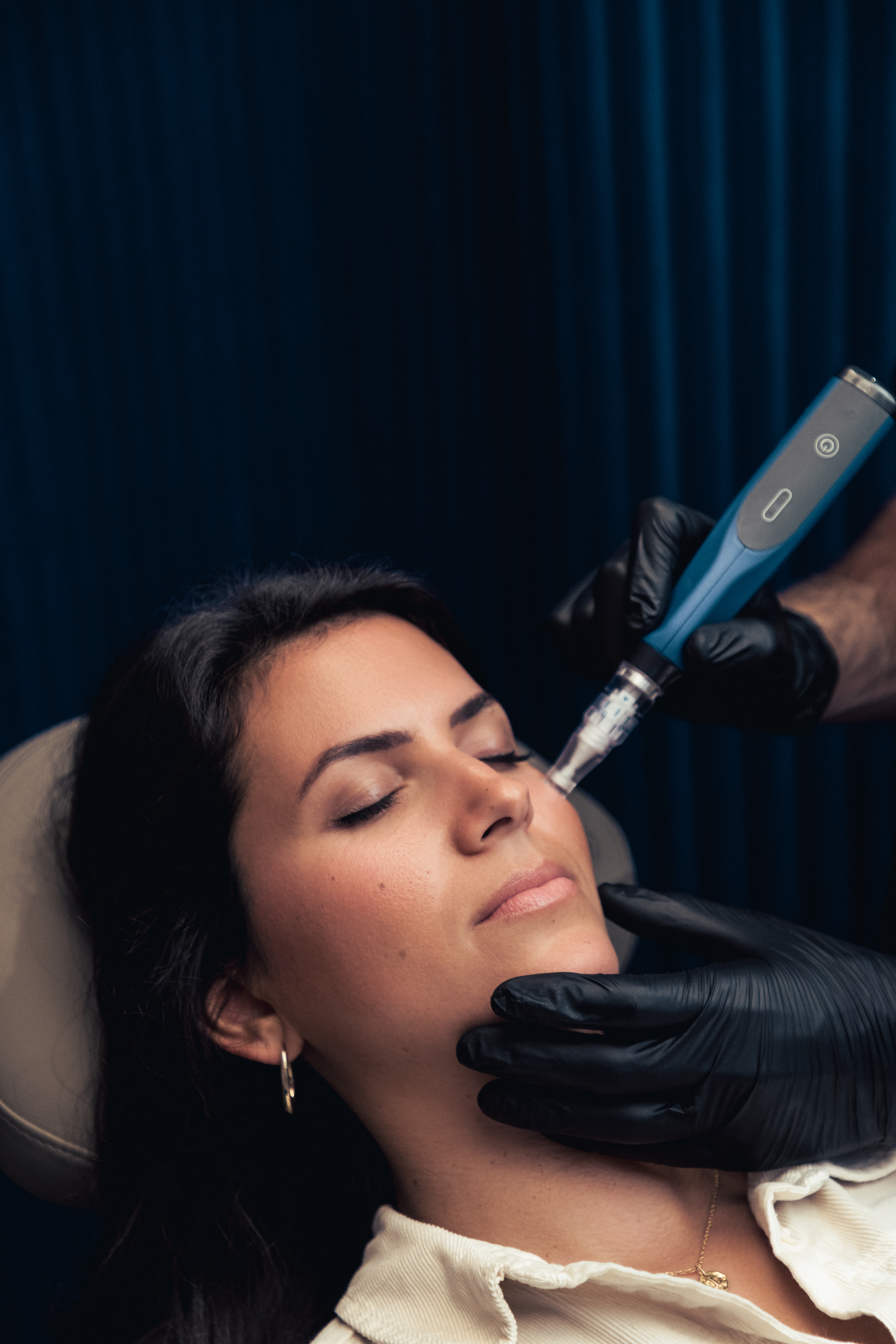 Médecin qui réalisé du microneedling sur une patiente 