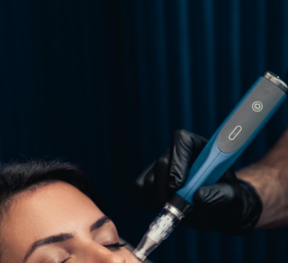 Médecin qui réalisé du microneedling sur une patiente