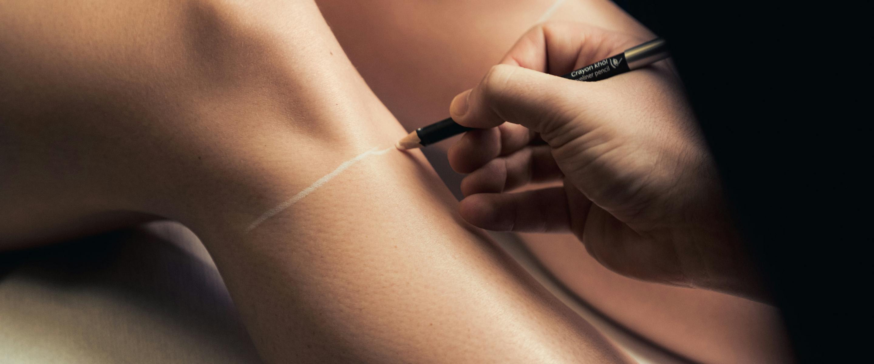 Épialtion laser jambes