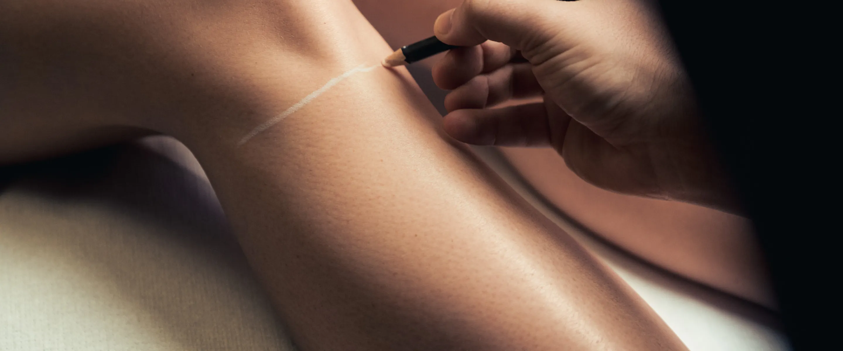 Épialtion laser jambes
