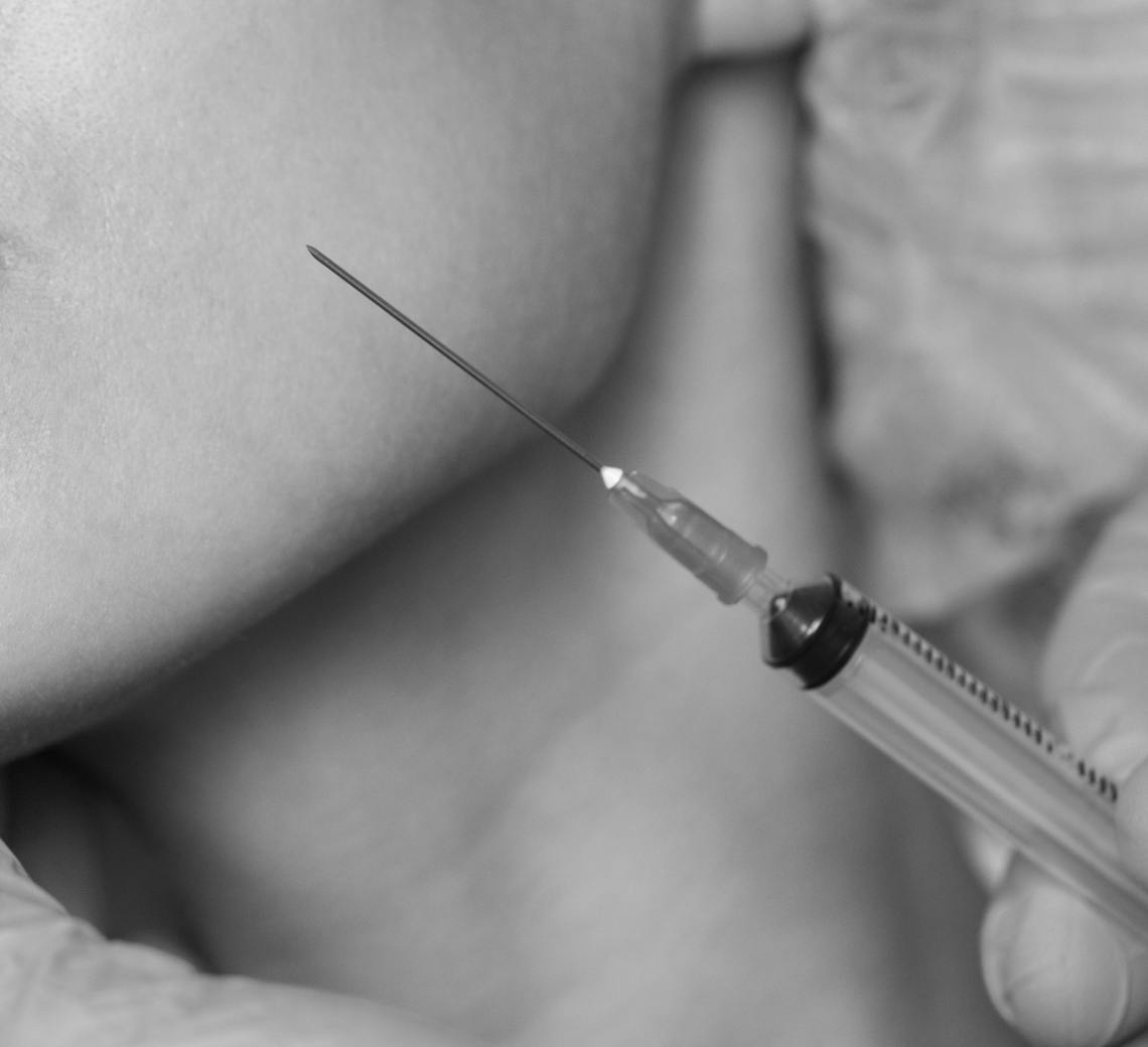 Botox thérapeutique et esthétique : quelles différences ?