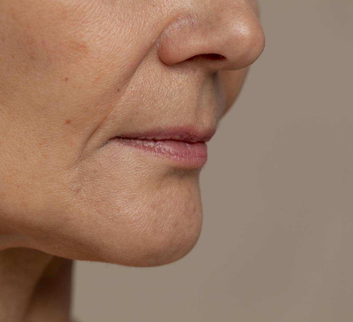 les différentes types de rides