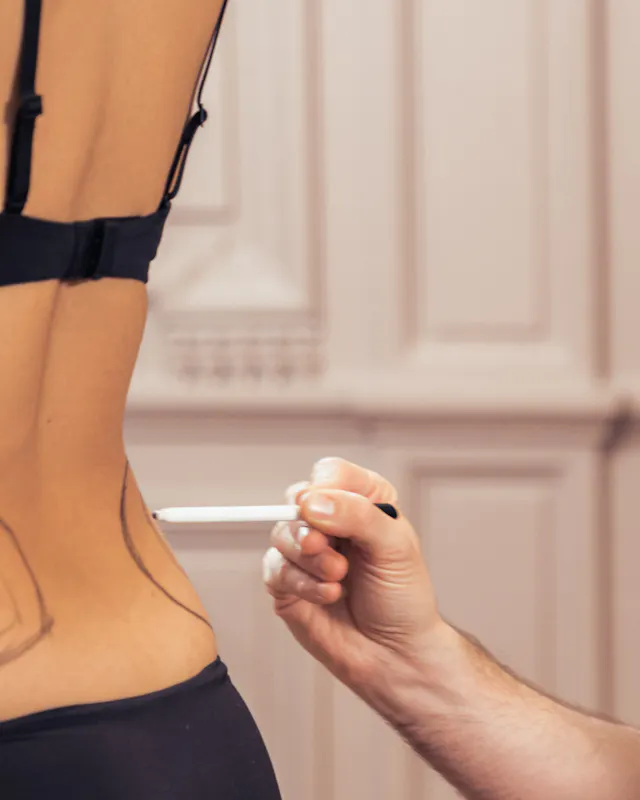 silhouette body contouring