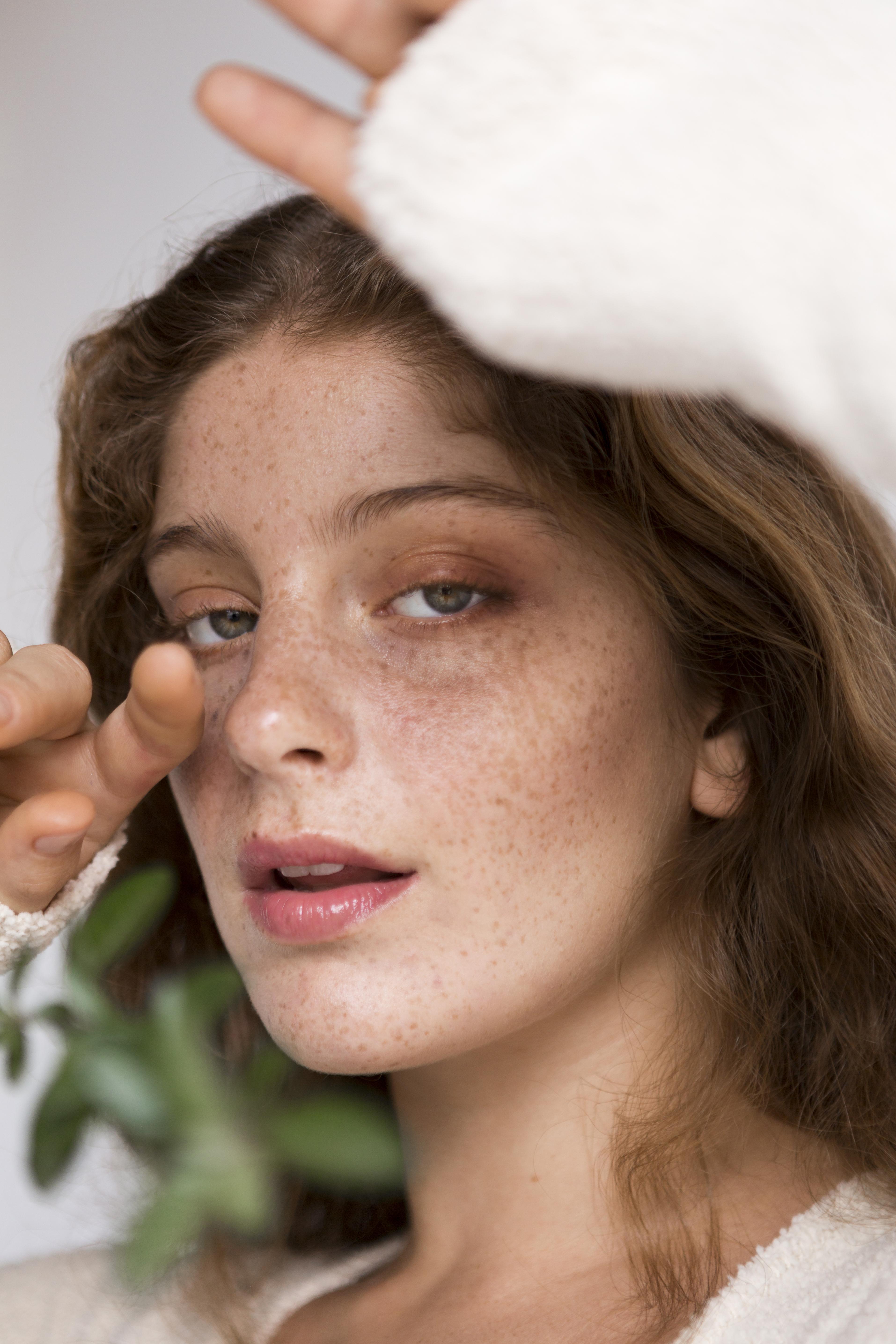 Faire des injections de Botox avant les fêtes : quel rendu ? 