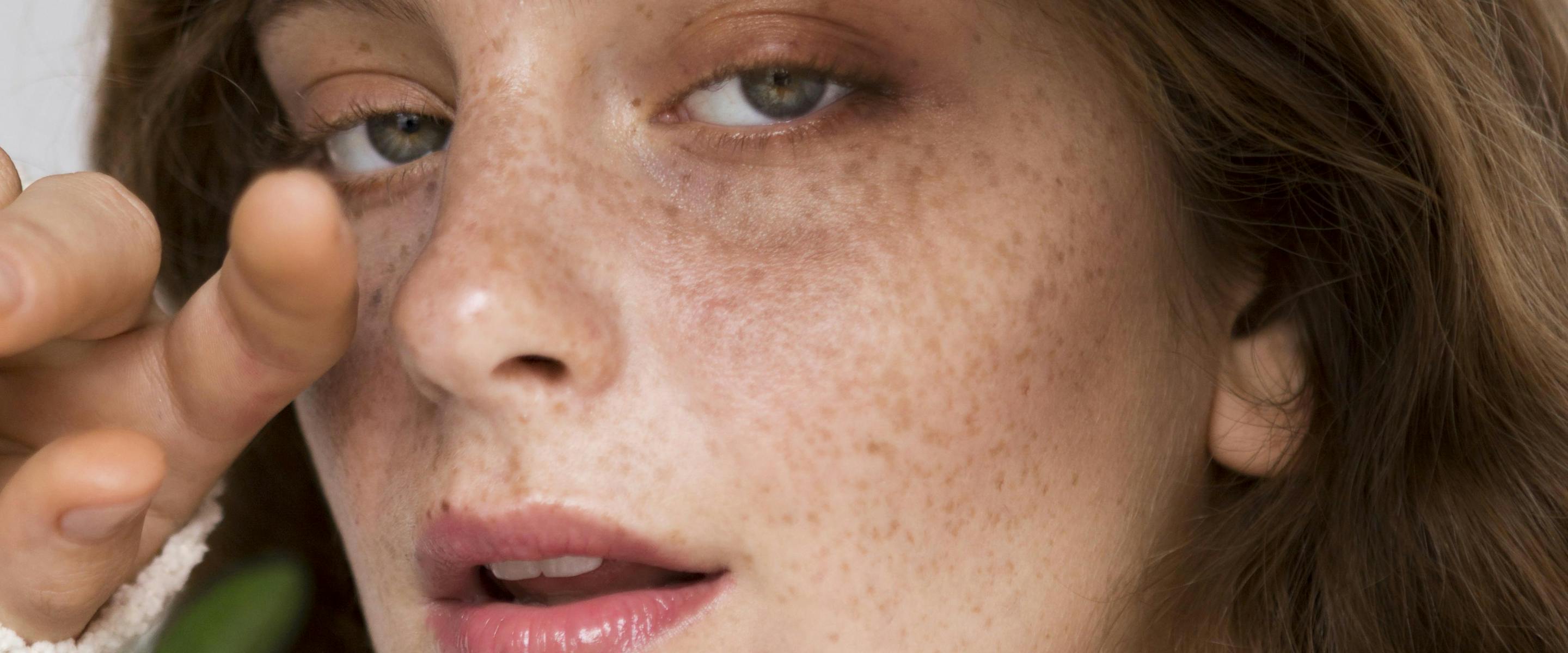 Faire des injections de Botox avant les fêtes : quel rendu ?