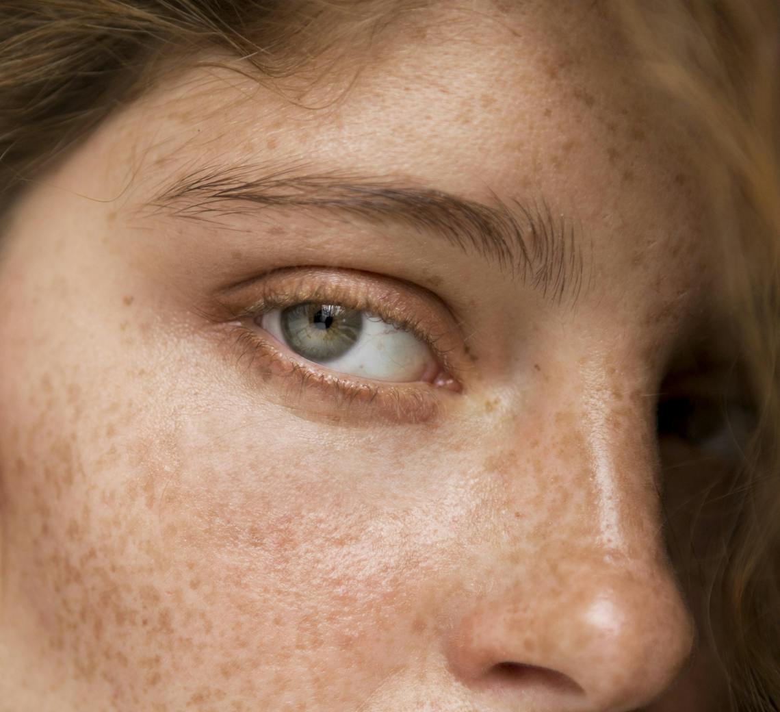 comment enlever les rides sous les yeux | Maison Yokō