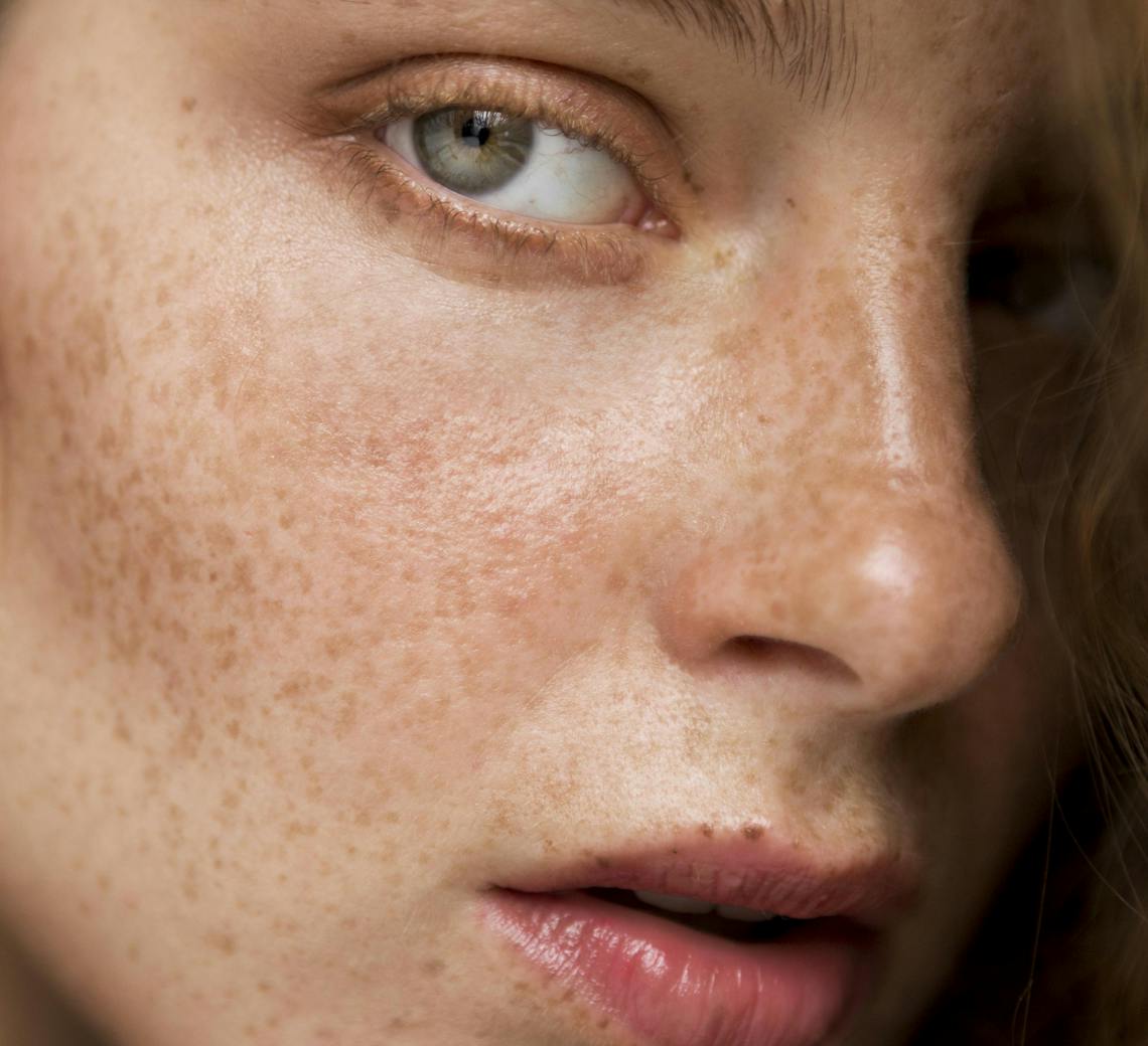 durée des injections d'acide hyaluronique