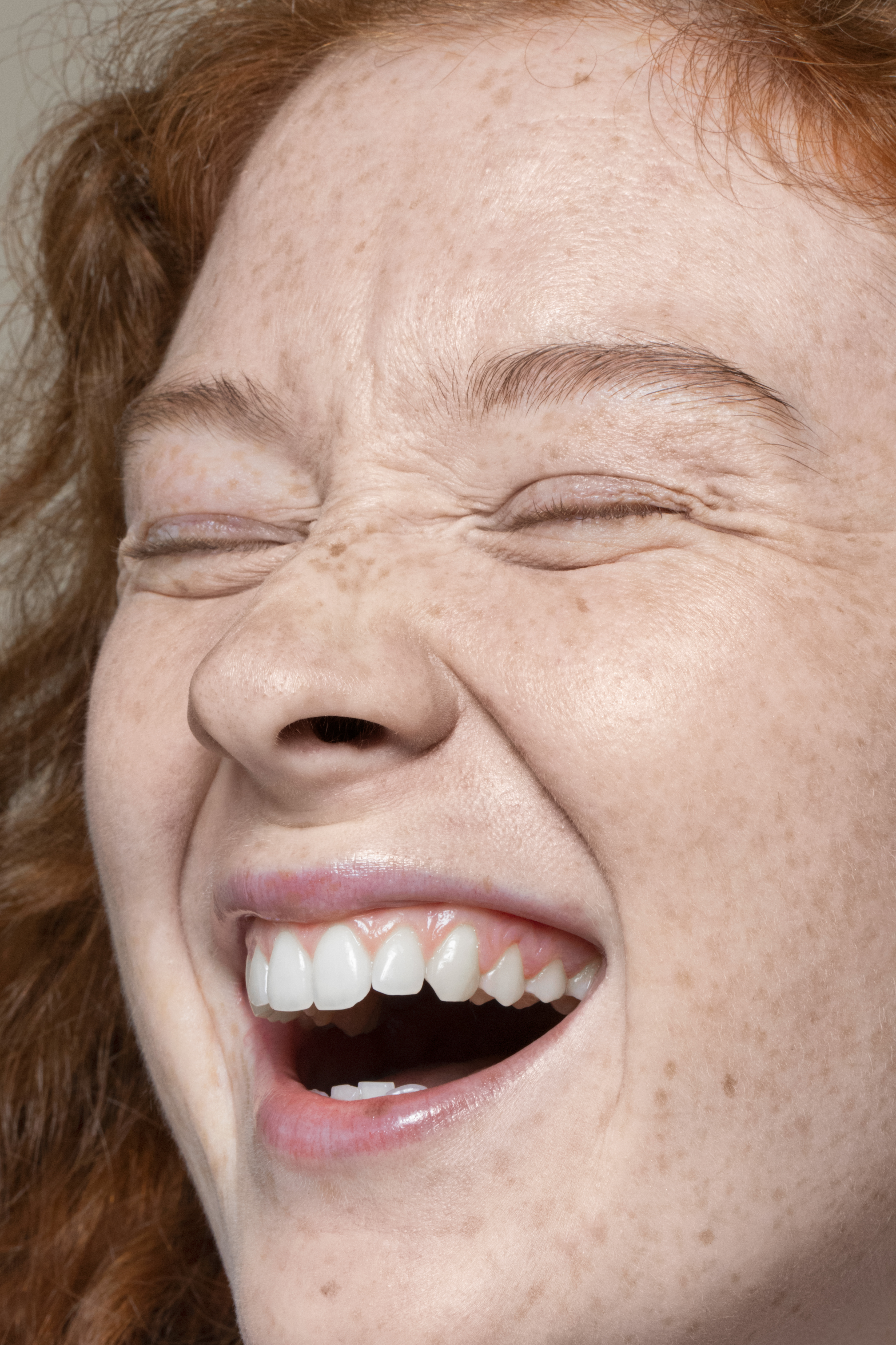 Injection de botox pour le sourire gingival | Maison Yokō