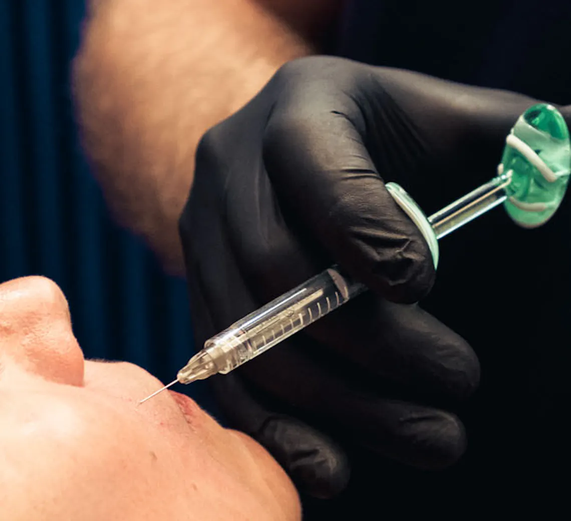 Ce qu'il se passe après une injection d'acide hyaluronique