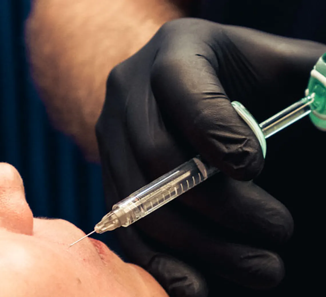 qu'est-ce que la grippe du botox ?