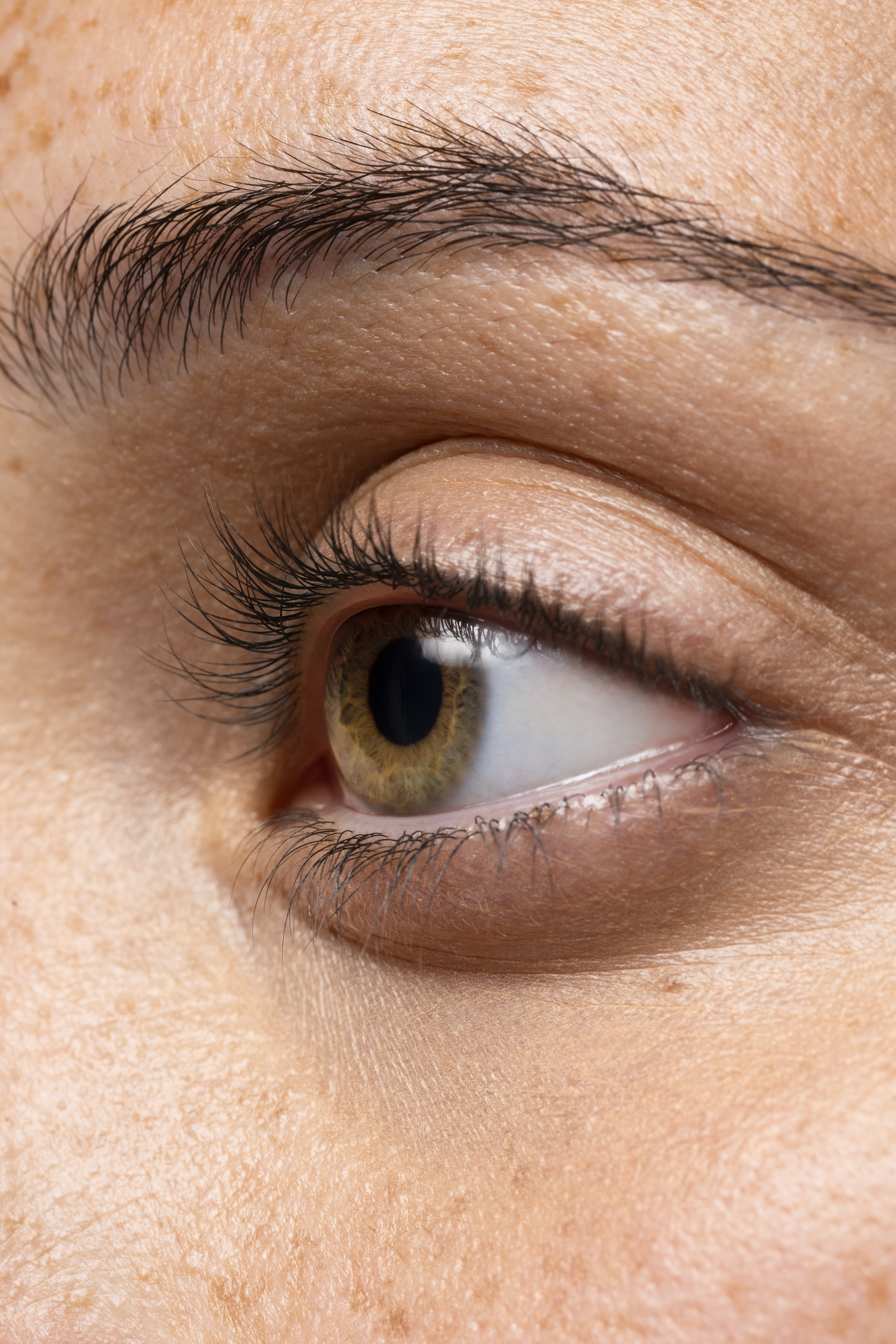 effets secondaire détatouage laser